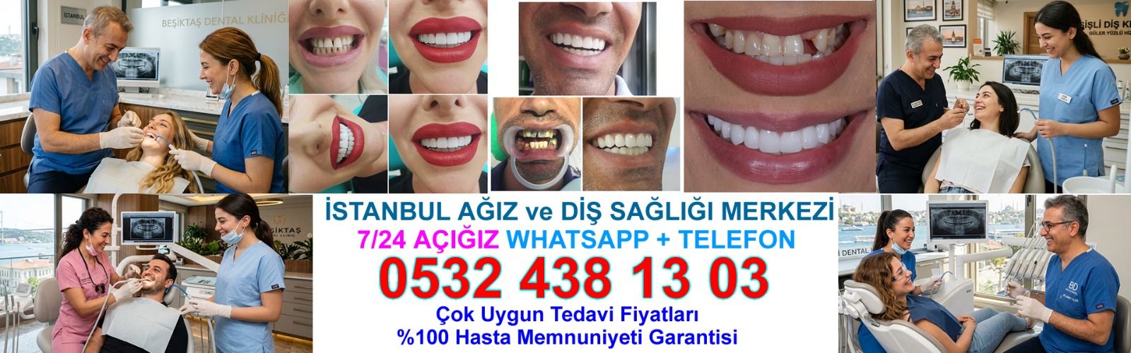 7/24 açık acil diş hastanesi İstanbul - nöbetçi diş hekimi